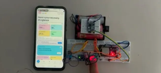 The SurgiGuard prototype: an ESP32 board with its sensors, a finger on the heart-rate sensor, and the app showing the live readings